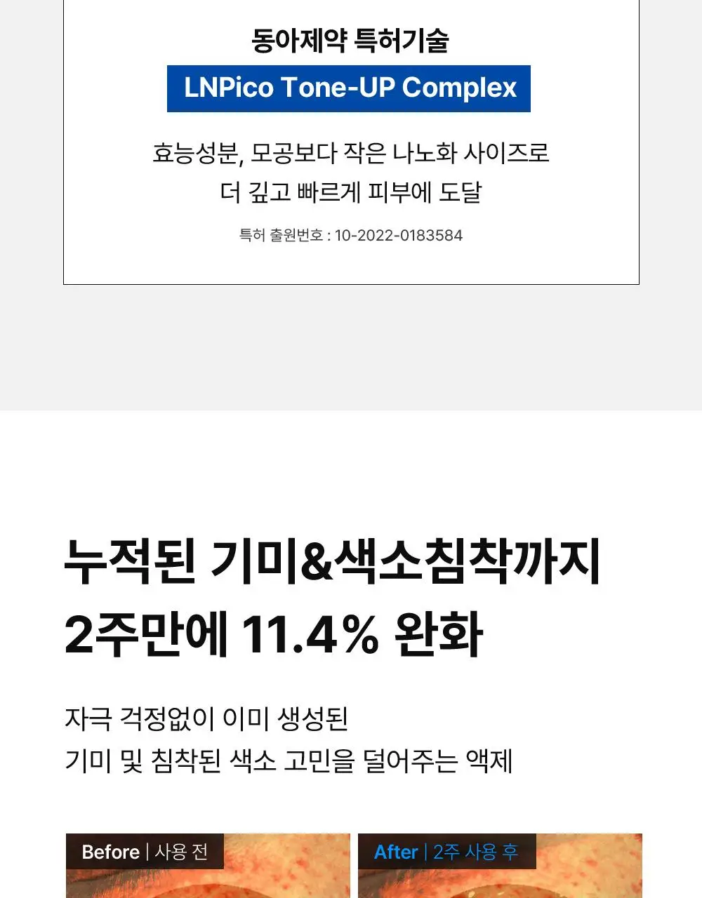 [단독기획] 동아제약 색소침착 프로 액제 30ml 기획(+크림제5ml) 상세페이지 14